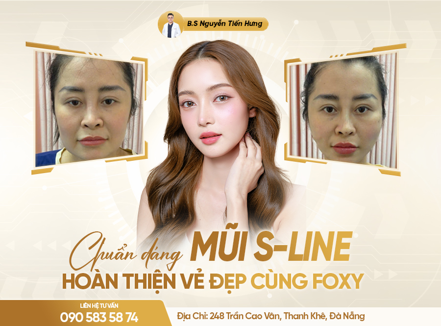 Chuẩn dáng mũi Sline, hoàn thiện vẻ đẹp cùng Foxy